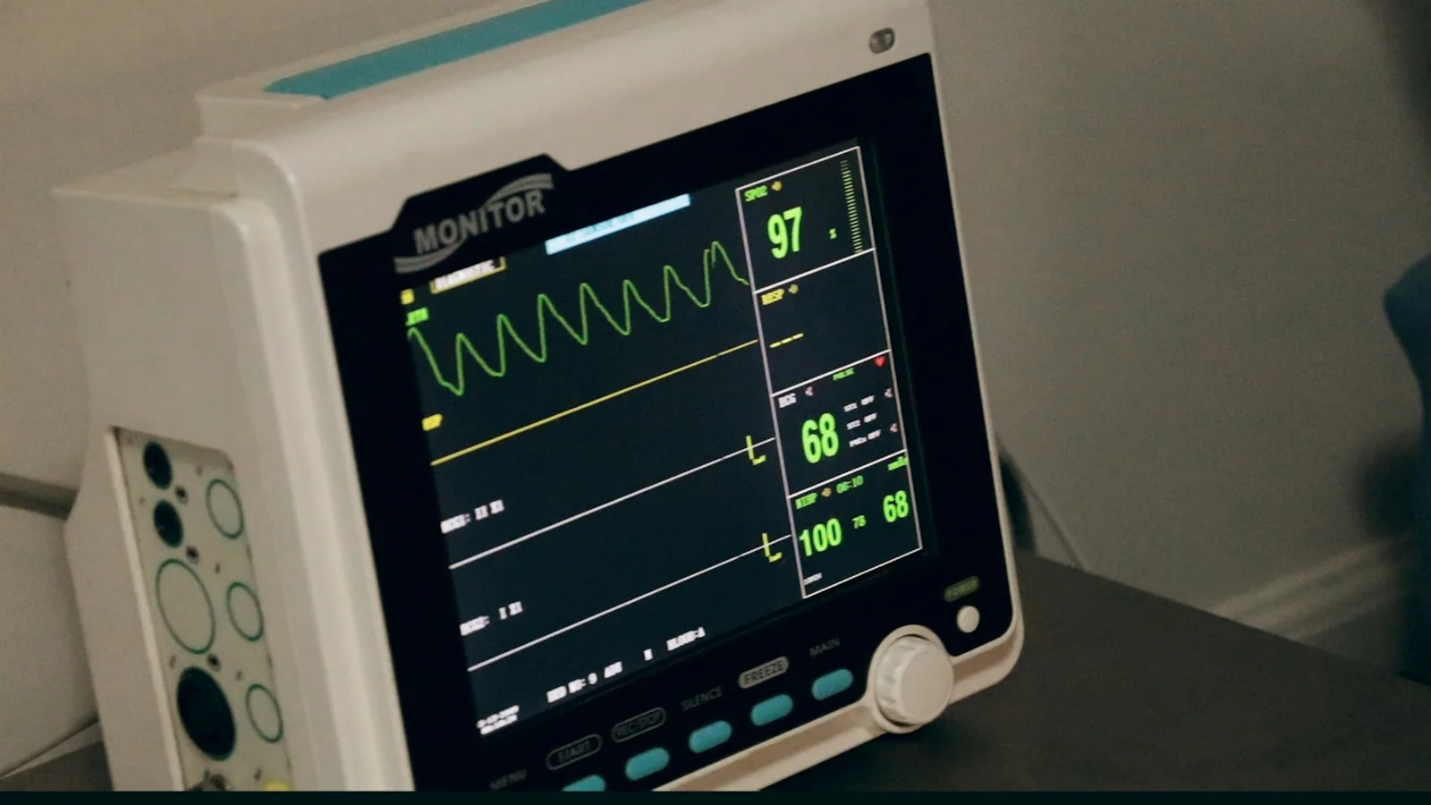 Photo of an ECG machine in a hospital showing the heart rate and other critical health information on the screen